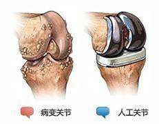 并发症