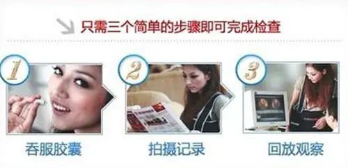 胶囊内镜