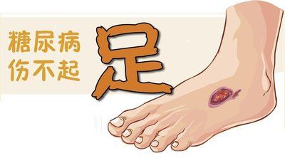 【桓医技术】中医妙手除沉疴：七旬糖足患者免于截肢之痛